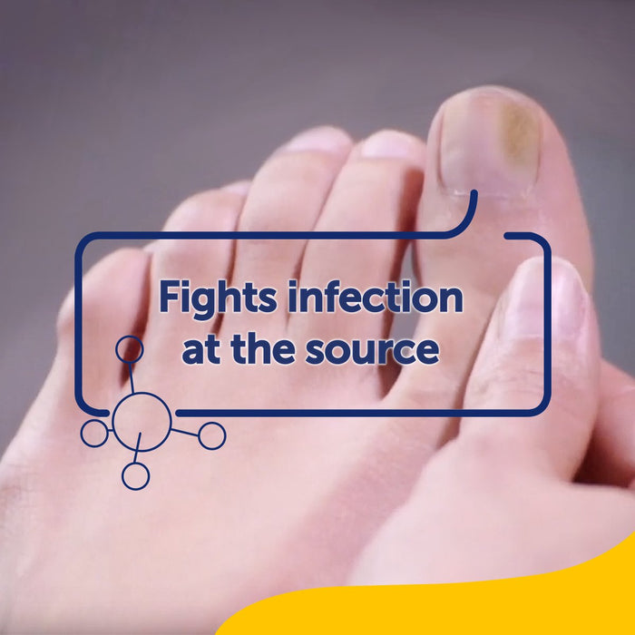 Scholl Aid Fungal Nail Treatment Kit